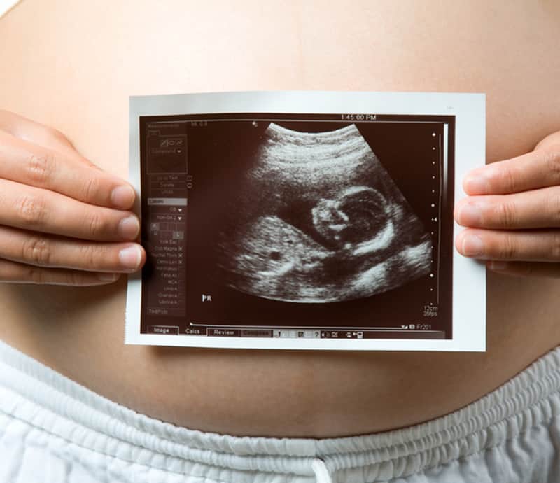 Primeira consulta pré-natal, o que levar, perguntar e como acontece? | Blog  da LVBB